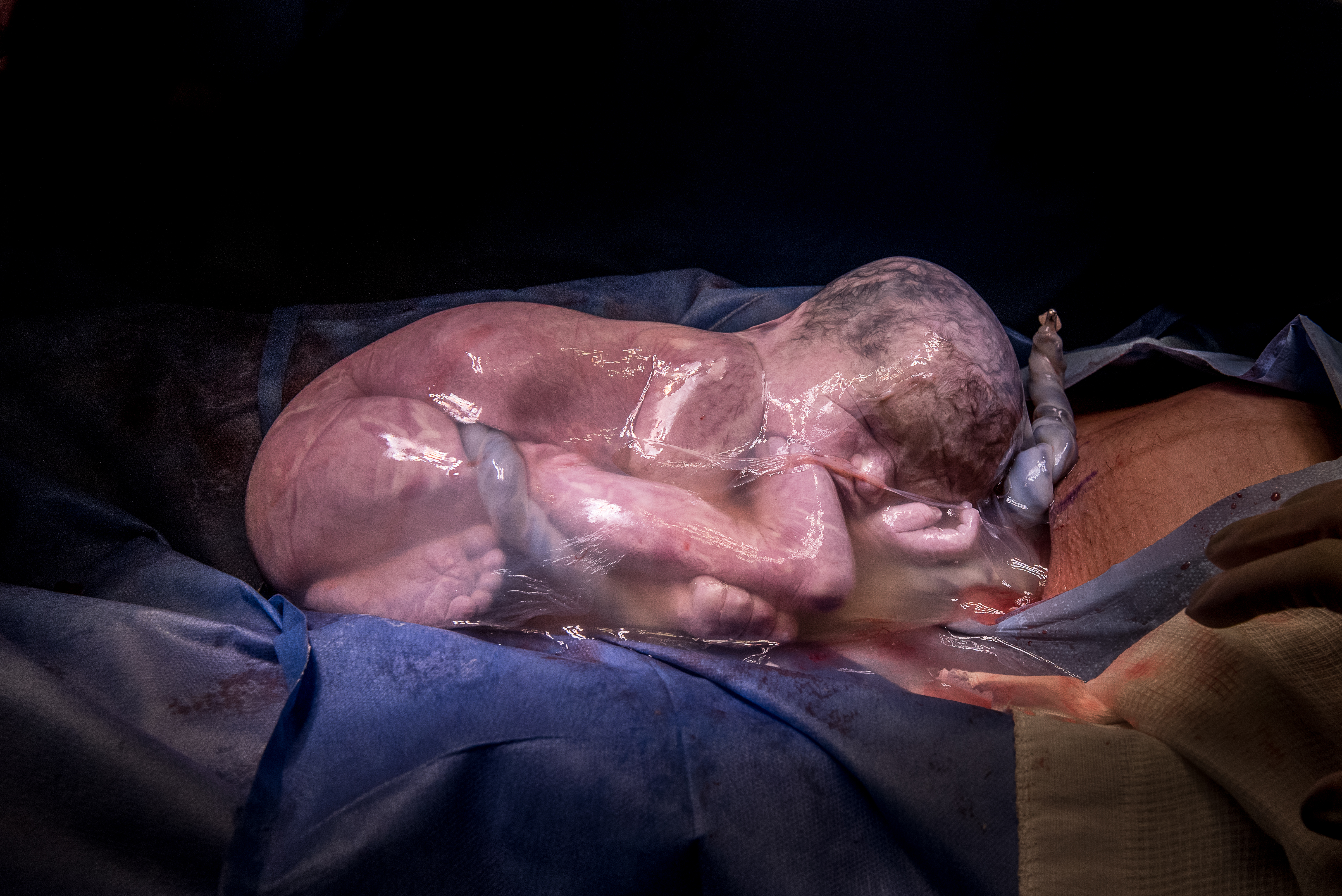 Bebê que nasceu dentro da bolsa gestacional foi uma das fotografias premiadas da fotógrafa Daniela Justus